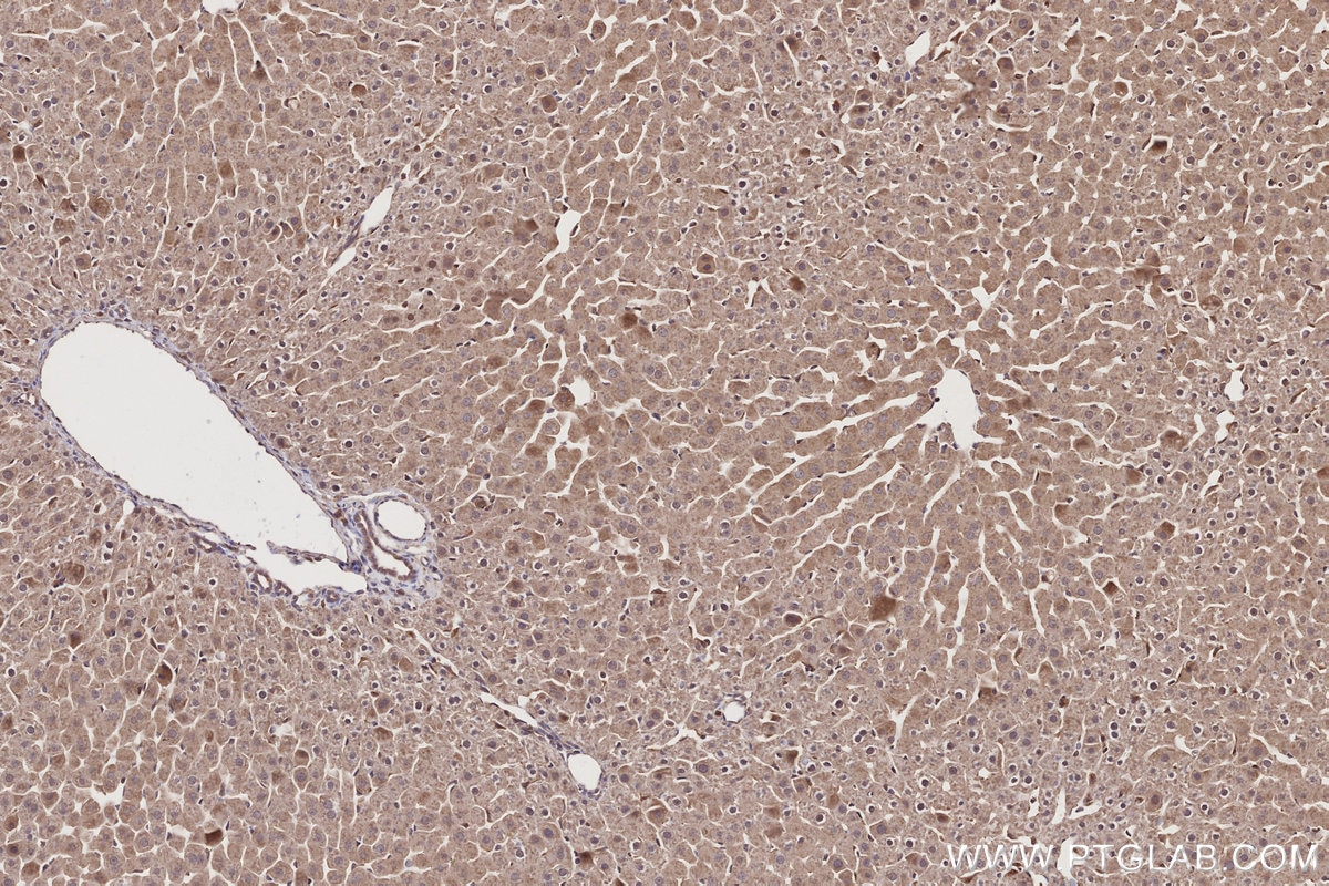 Immunohistochemical analysis of paraffin-embedded rat liver tissue slide using KHC2731 (FRS2 IHC Kit).