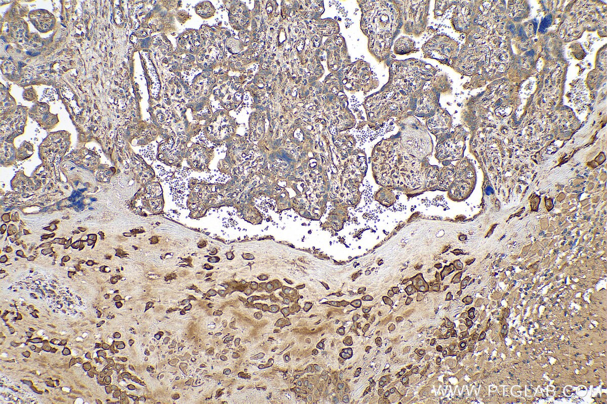 Immunohistochemical analysis of paraffin-embedded human placenta tissue slide using KHC0794 (FSTL1 IHC Kit).