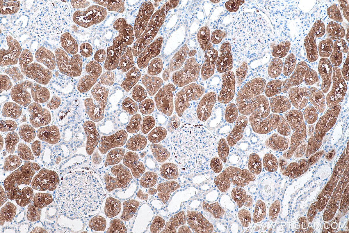 Immunohistochemical analysis of paraffin-embedded human kidney tissue slide using KHC0533 (FTCD IHC Kit).