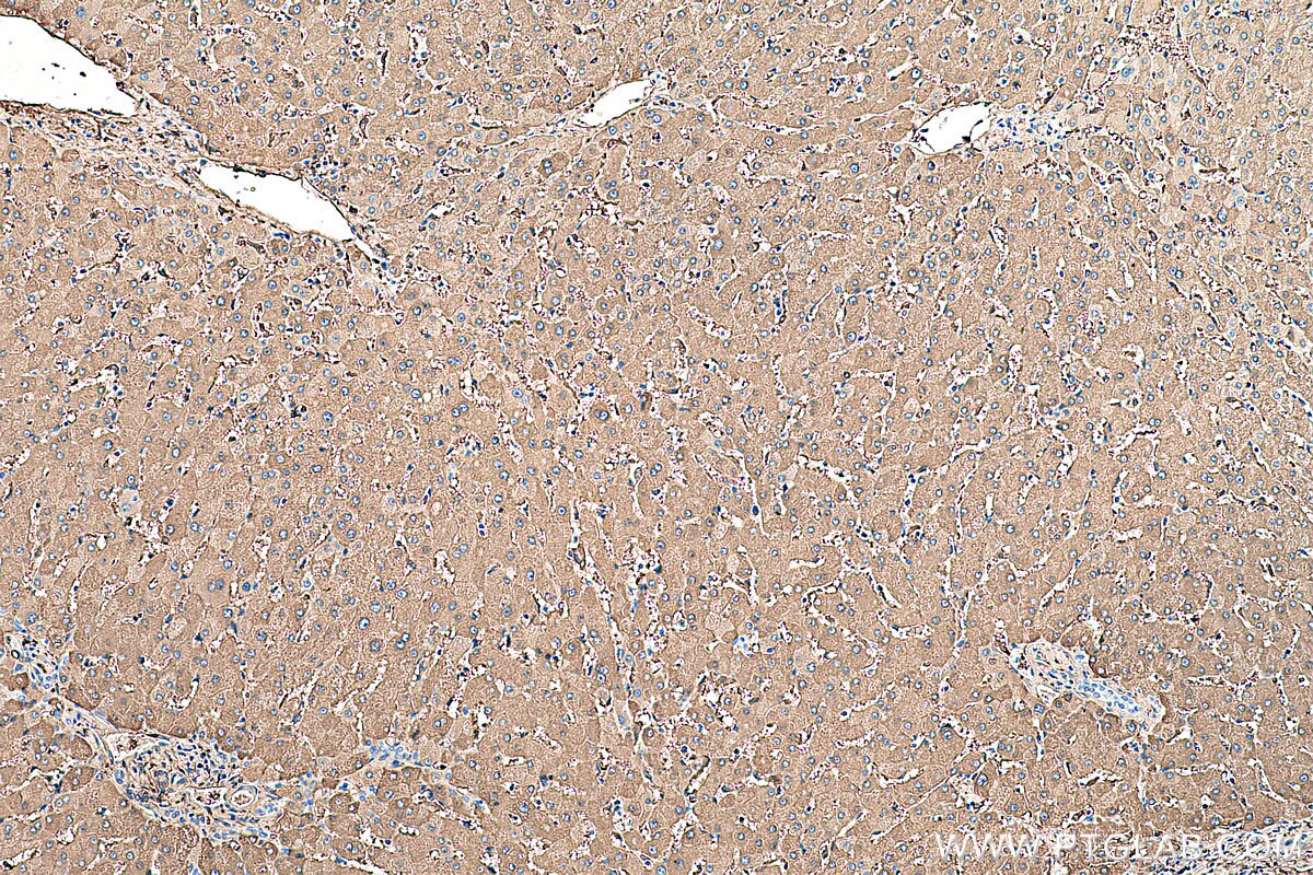 Immunohistochemical analysis of paraffin-embedded human liver tissue slide using KHC0419 (FTL IHC Kit).