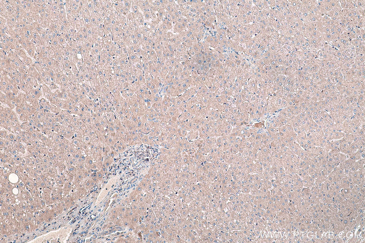 Immunohistochemical analysis of paraffin-embedded human liver tissue slide using KHC0181 (FTSJ1 IHC Kit).