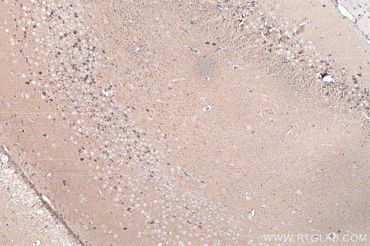 Immunohistochemical analysis of paraffin-embedded mouse brain tissue slide using KHC0181 (FTSJ1 IHC Kit).