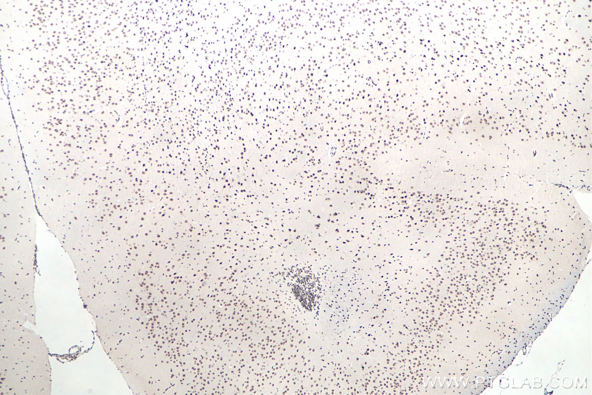 Immunohistochemical analysis of paraffin-embedded mouse brain tissue slide using KHC0057 (FUS/TLS IHC Kit).