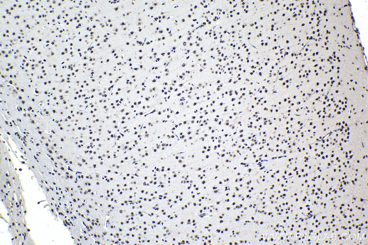 Immunohistochemical analysis of paraffin-embedded rat brain tissue slide using KHC0937 (FUS/TLS IHC Kit).