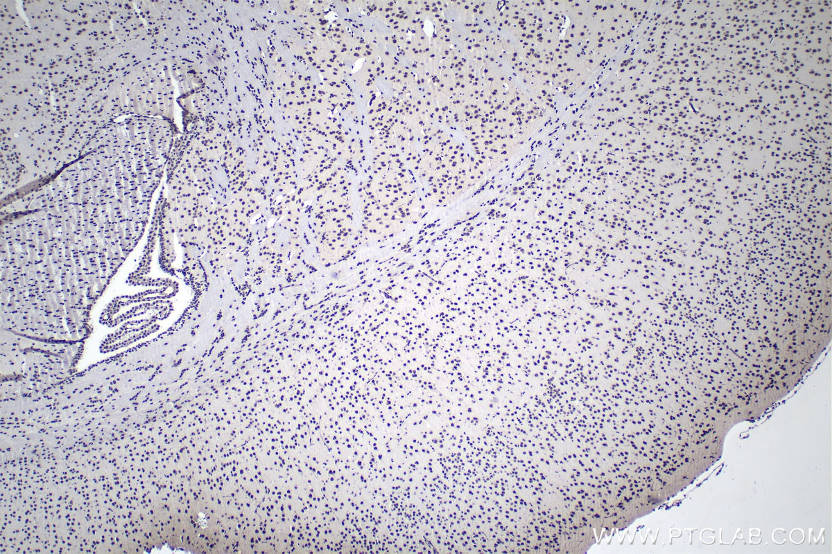 Immunohistochemical analysis of paraffin-embedded mouse brain tissue slide using KHC0937 (FUS/TLS IHC Kit).