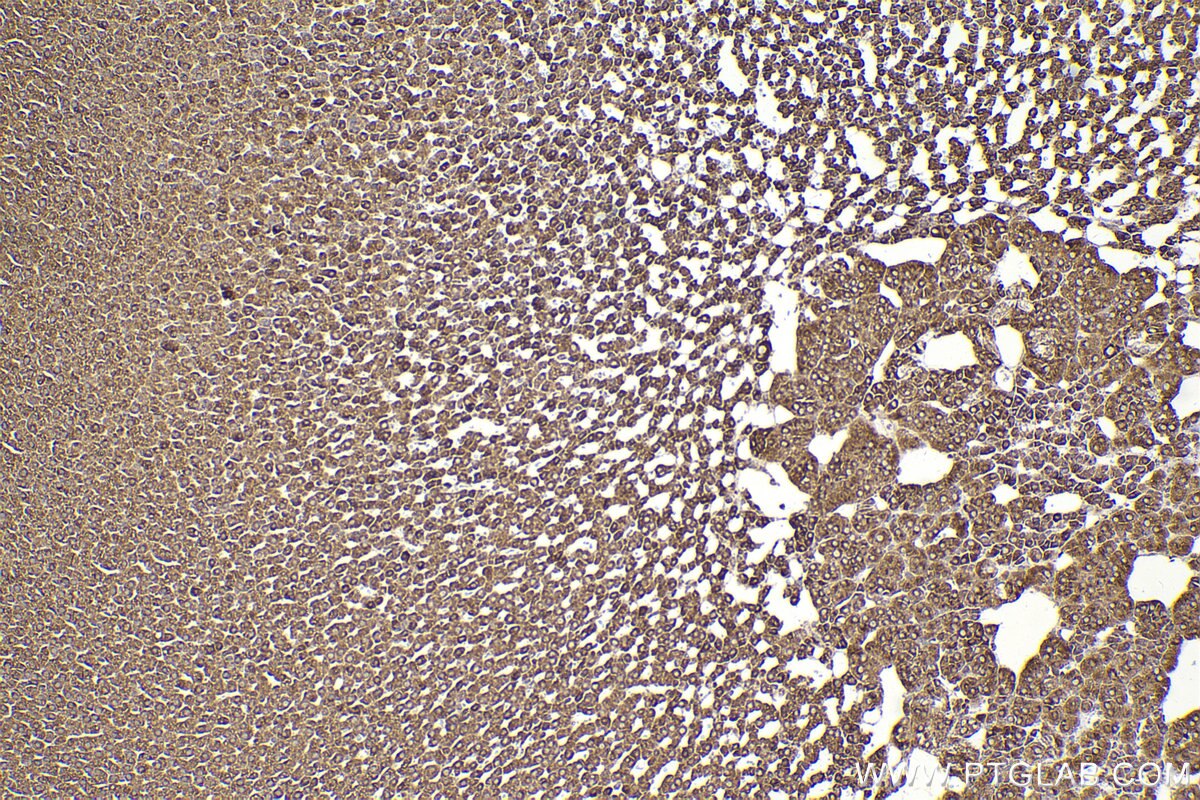 Immunohistochemical analysis of paraffin-embedded rat adrenal gland tissue slide using KHC2299 (FXR1 IHC Kit).