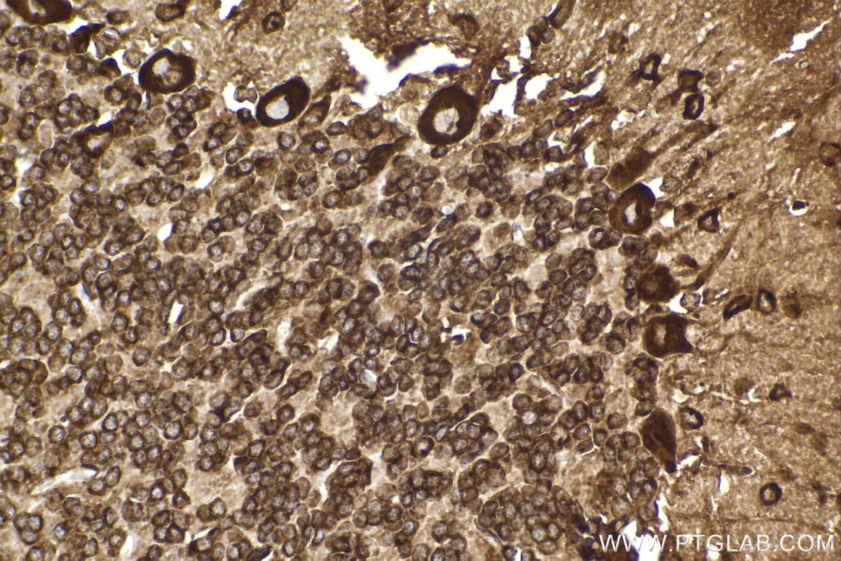 Immunohistochemical analysis of paraffin-embedded rat cerebellum tissue slide using KHC2299 (FXR1 IHC Kit).