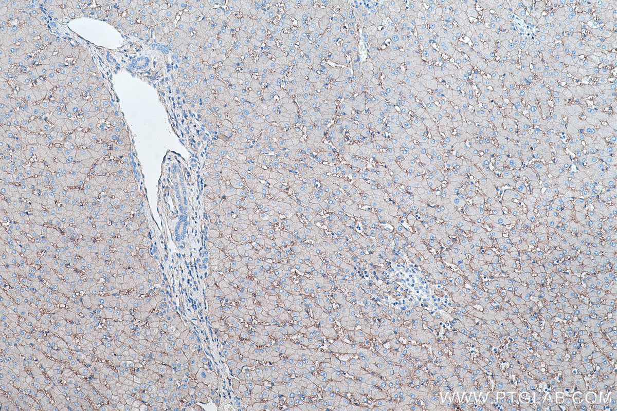 Immunohistochemical analysis of paraffin-embedded human liver tissue slide using KHC0420 (FXYD1 IHC Kit).