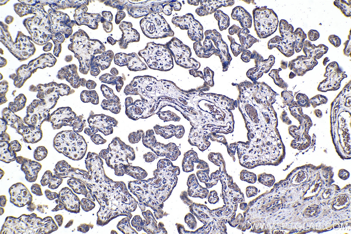 Immunohistochemical analysis of paraffin-embedded human placenta tissue slide using KHC1067 (FZD7 IHC Kit).