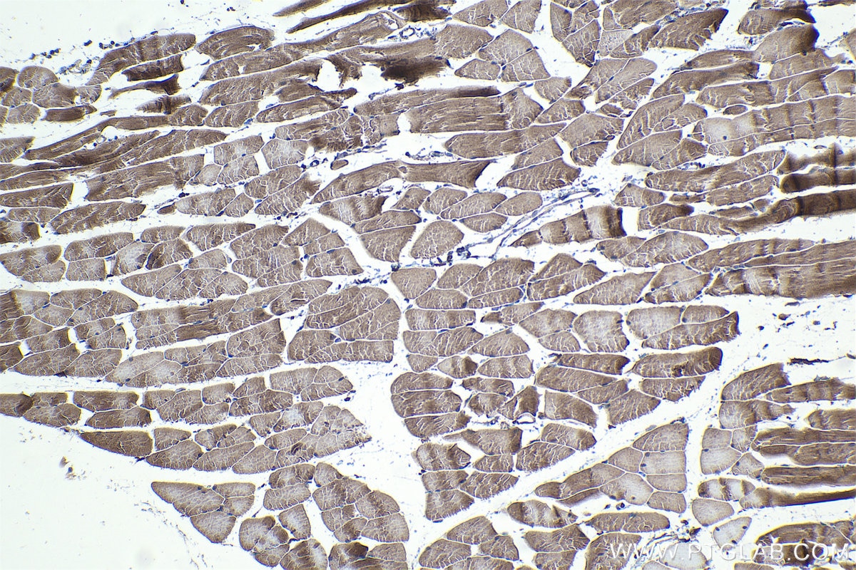 Immunohistochemical analysis of paraffin-embedded mouse skeletal muscle tissue slide using KHC1067 (FZD7 IHC Kit).