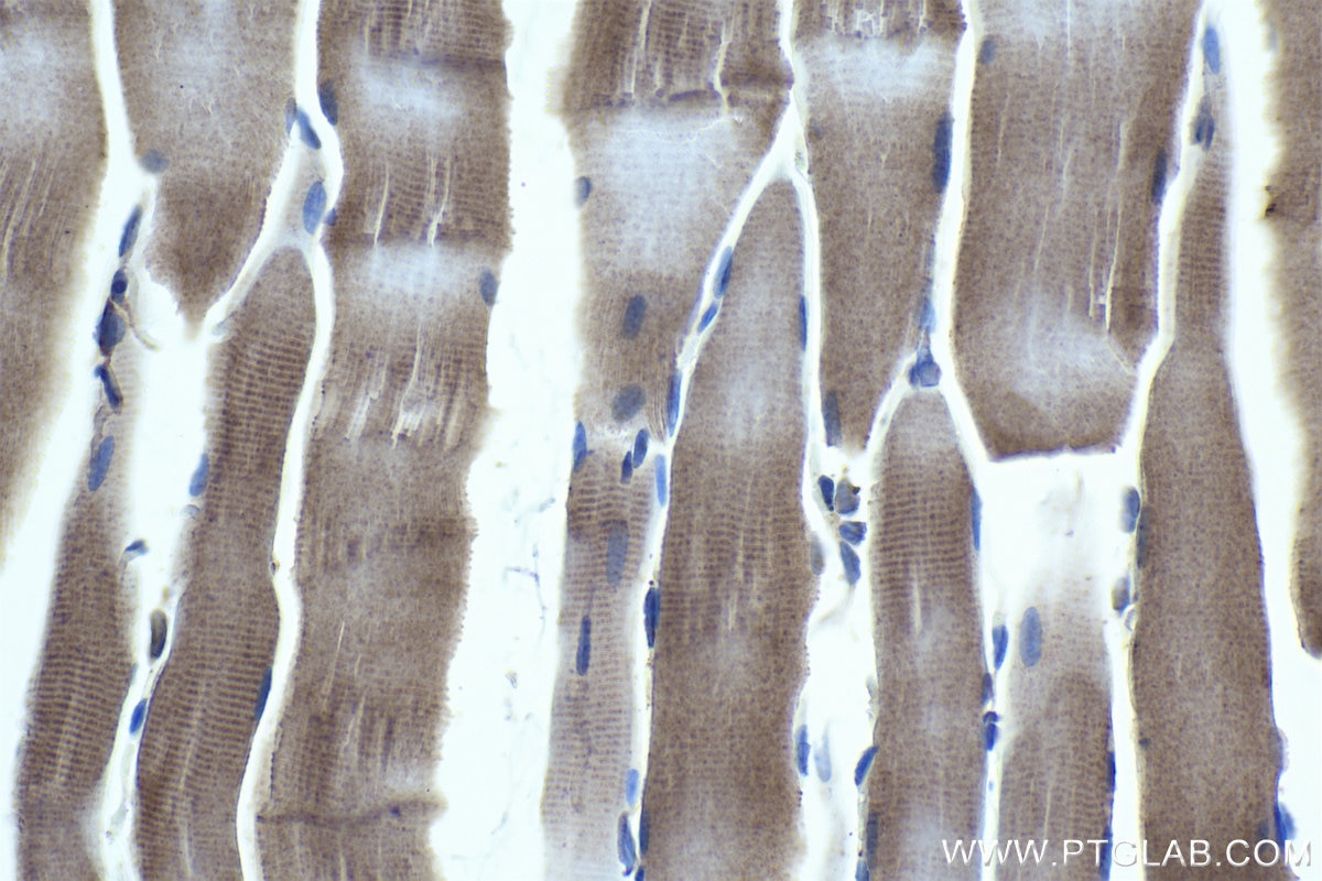 Immunohistochemical analysis of paraffin-embedded rat skeletal muscle tissue slide using KHC1067 (FZD7 IHC Kit).