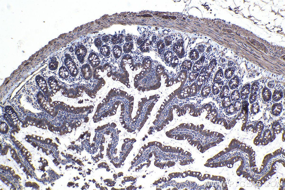 Immunohistochemical analysis of paraffin-embedded rat small intestine tissue slide using KHC1067 (FZD7 IHC Kit).