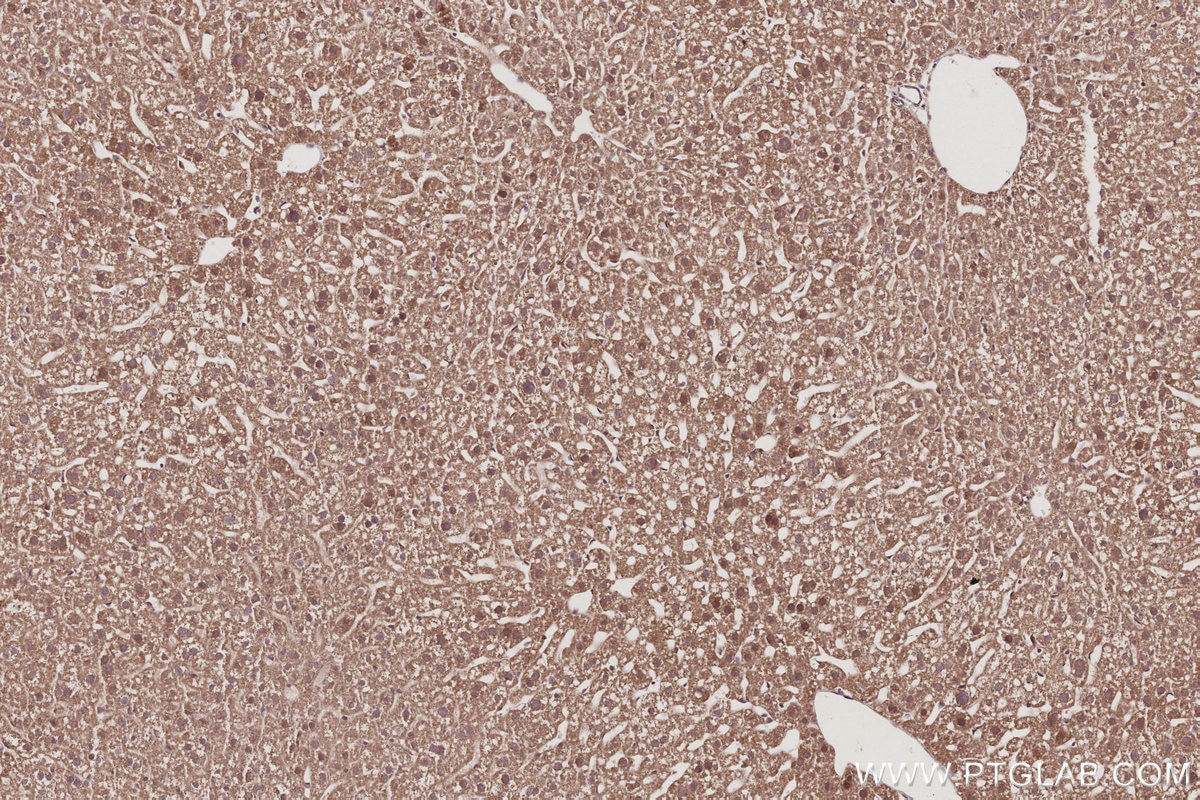 Immunohistochemical analysis of paraffin-embedded mouse liver tissue slide using KHC3039 (FZR1 IHC Kit).