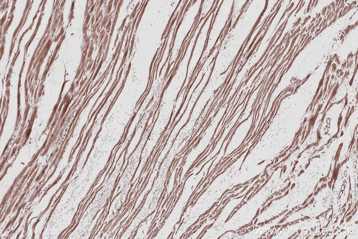 Immunohistochemical analysis of paraffin-embedded rat heart tissue slide using KHC3039 (FZR1 IHC Kit).