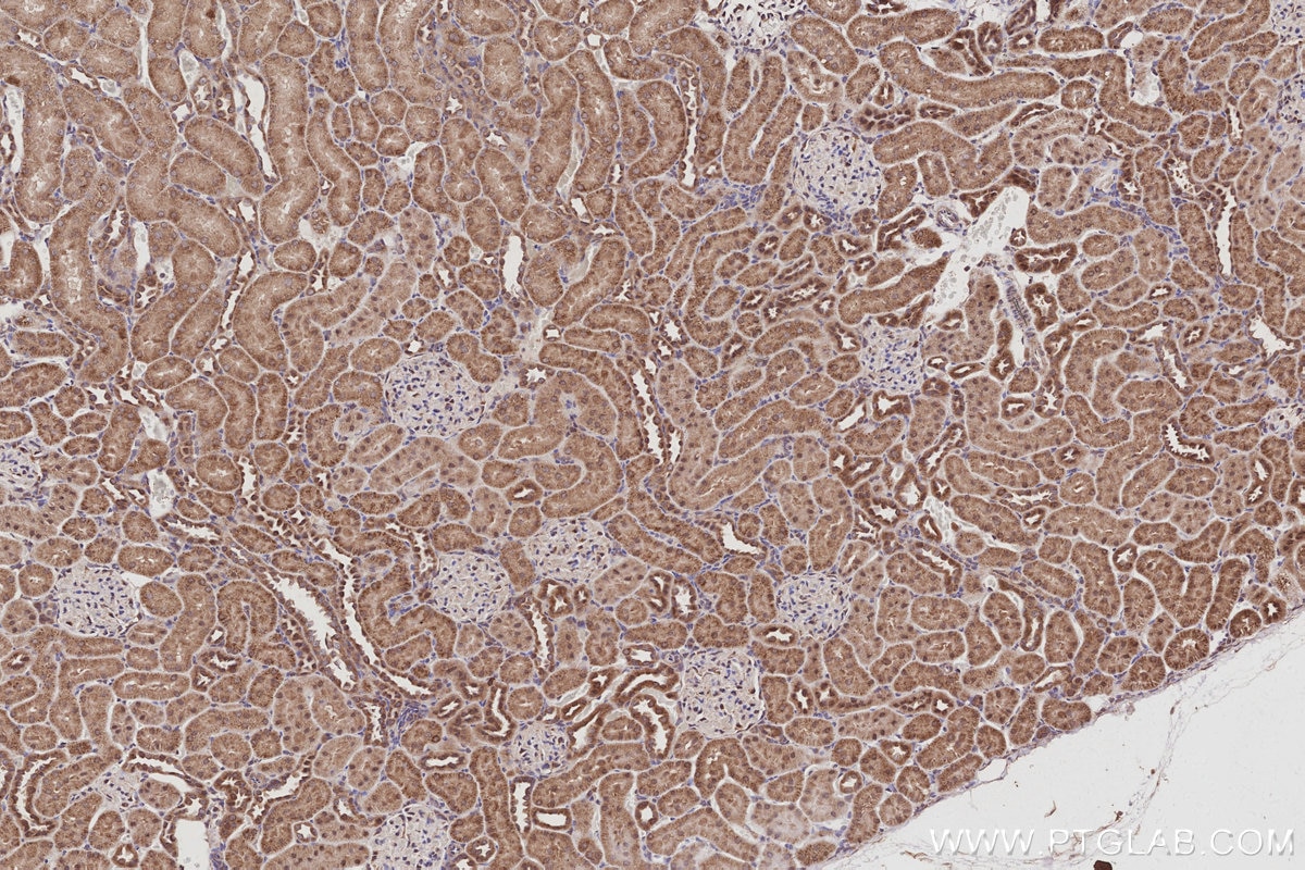 Immunohistochemical analysis of paraffin-embedded rat kidney tissue slide using KHC3039 (FZR1 IHC Kit).