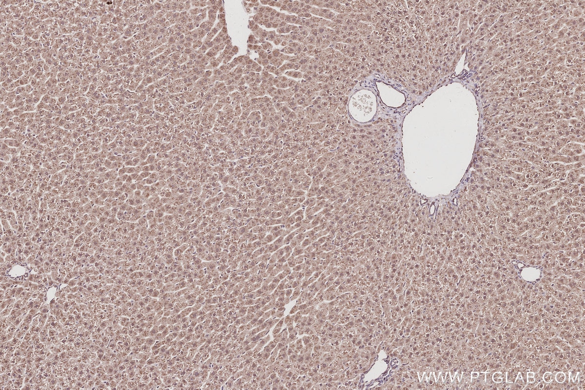 Immunohistochemical analysis of paraffin-embedded rat liver tissue slide using KHC3039 (FZR1 IHC Kit).