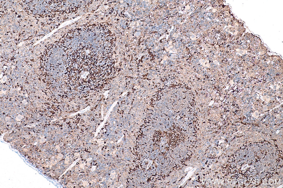 Immunohistochemical analysis of paraffin-embedded mouse spleen tissue slide using KHC0772 (Fascin IHC Kit).