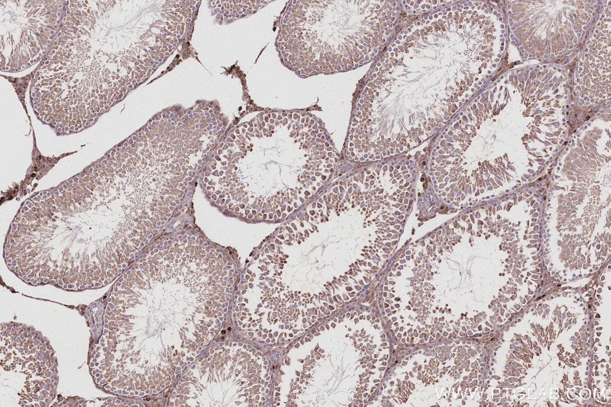 Immunohistochemical analysis of paraffin-embedded rat testis tissue slide using KHC3025 (Fetuin-B IHC Kit). Immunohistochemical analysis of paraffin-embedded rat testis tissue slide using KHC3025 (Fetuin-B IHC Kit).
