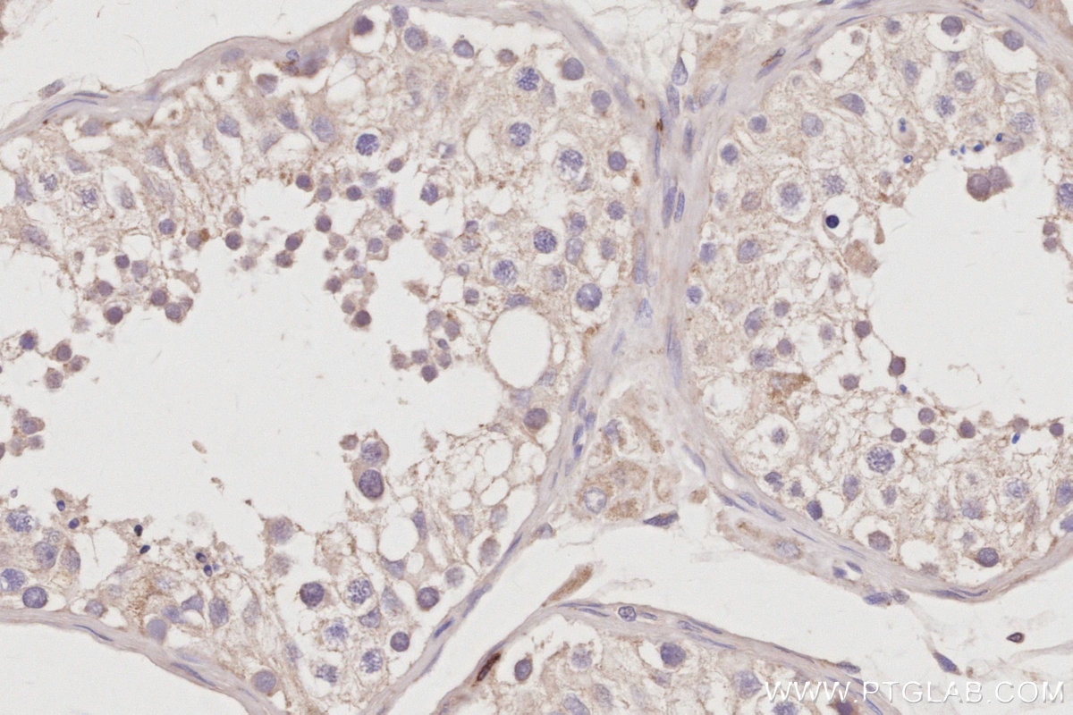 Immunohistochemical analysis of paraffin-embedded human testis tissue slide using KHC3025 (Fetuin-B IHC Kit). Immunohistochemical analysis of paraffin-embedded human testis tissue slide using KHC3025 (Fetuin-B IHC Kit).