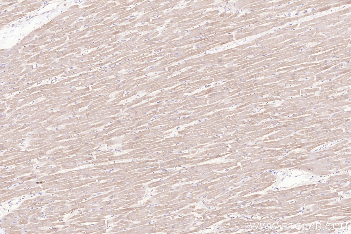 Immunohistochemical analysis of paraffin-embedded human heart tissue slide using KHC3257 (Frataxin IHC Kit).