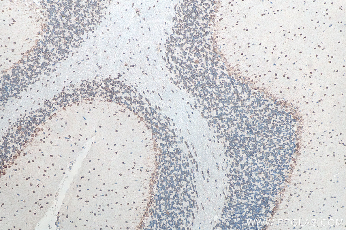 Immunohistochemical analysis of paraffin-embedded rat cerebellum tissue slide using KHC0047 (G3BP1 IHC Kit).