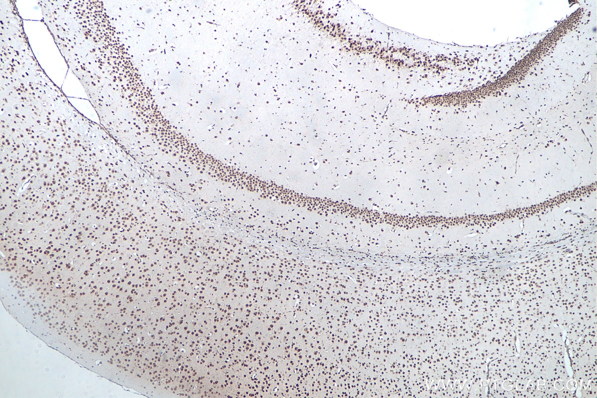 Immunohistochemical analysis of paraffin-embedded mouse brain tissue slide using KHC0047 (G3BP1 IHC Kit).