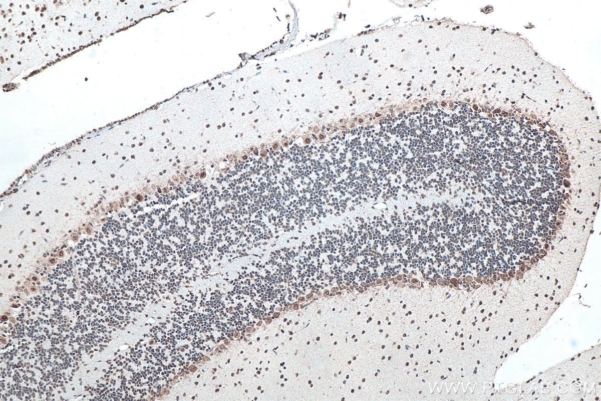 Immunohistochemical analysis of paraffin-embedded mouse cerebellum tissue slide using KHC0047 (G3BP1 IHC Kit).