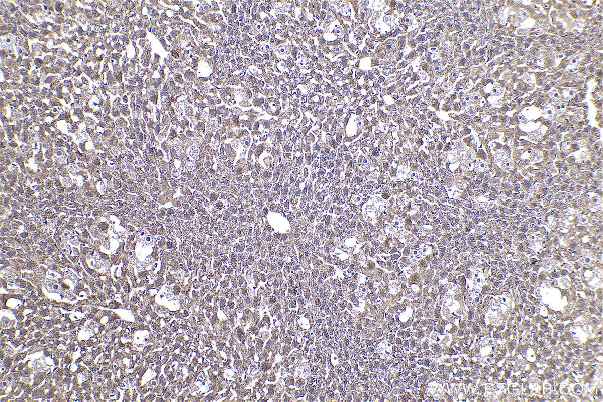 Immunohistochemical analysis of paraffin-embedded mouse liver tissue slide using KHC0935 (G3BP2 IHC Kit).