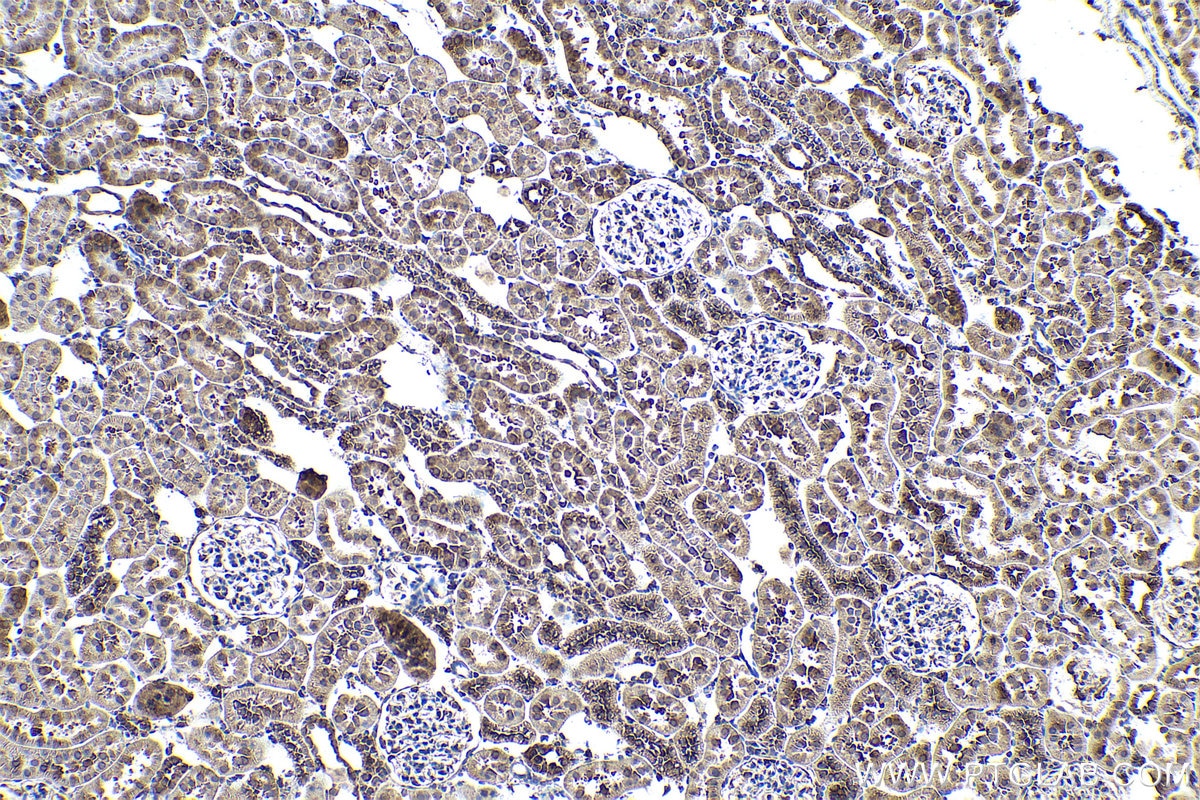 Immunohistochemical analysis of paraffin-embedded rat kidney tissue slide using KHC0935 (G3BP2 IHC Kit).