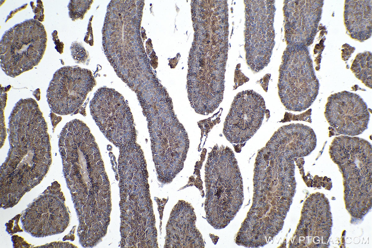 Immunohistochemical analysis of paraffin-embedded mouse testis tissue slide using KHC0876 (G6PD IHC Kit).