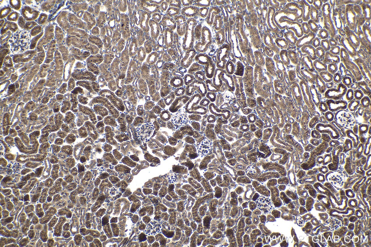 Immunohistochemical analysis of paraffin-embedded mouse kidney tissue slide using KHC0971 (GAA IHC Kit).