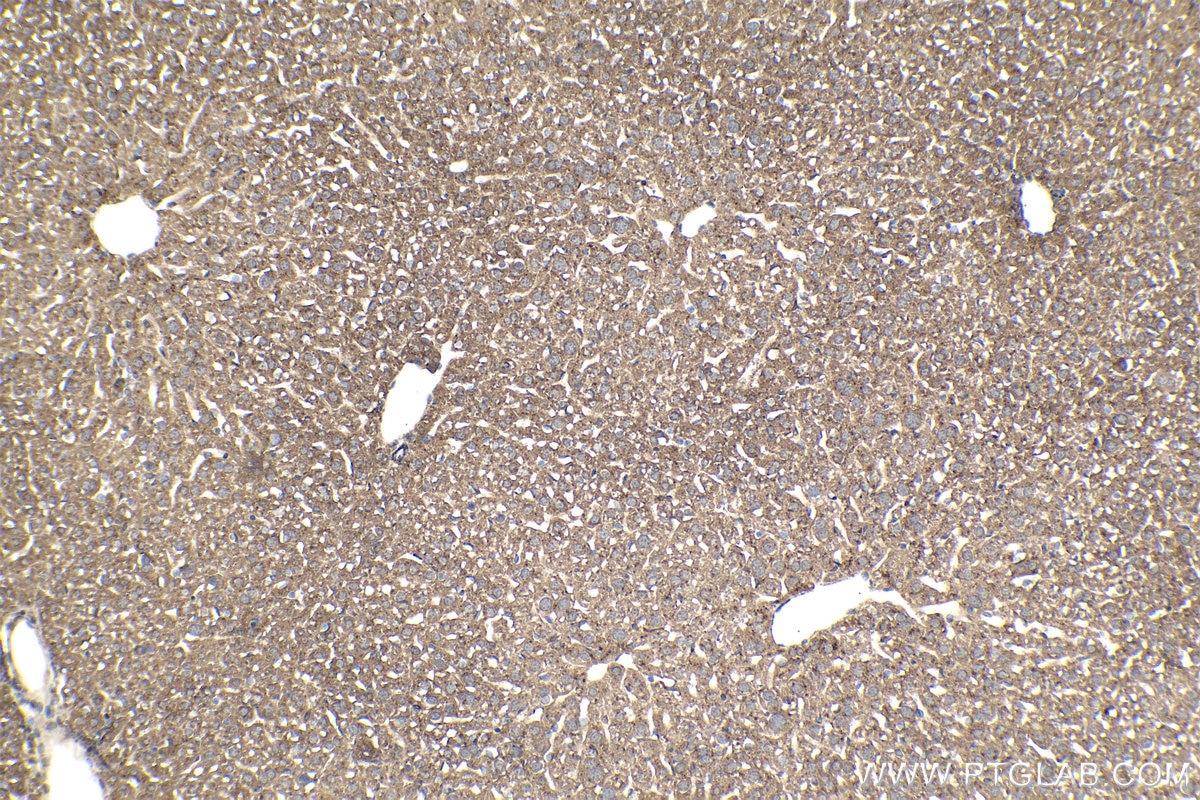 Immunohistochemical analysis of paraffin-embedded mouse liver tissue slide using KHC0971 (GAA IHC Kit).