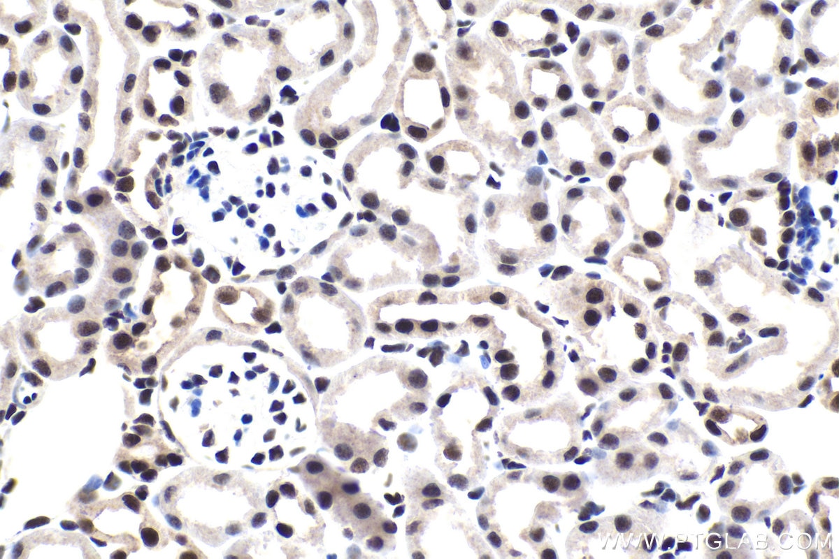 Immunohistochemical analysis of paraffin-embedded mouse kidney tissue slide using KHC1682 (GABPA IHC Kit).
