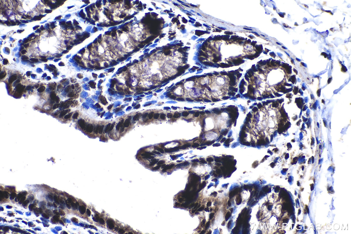 Immunohistochemical analysis of paraffin-embedded mouse colon tissue slide using KHC1384 (GABPB1 IHC Kit).