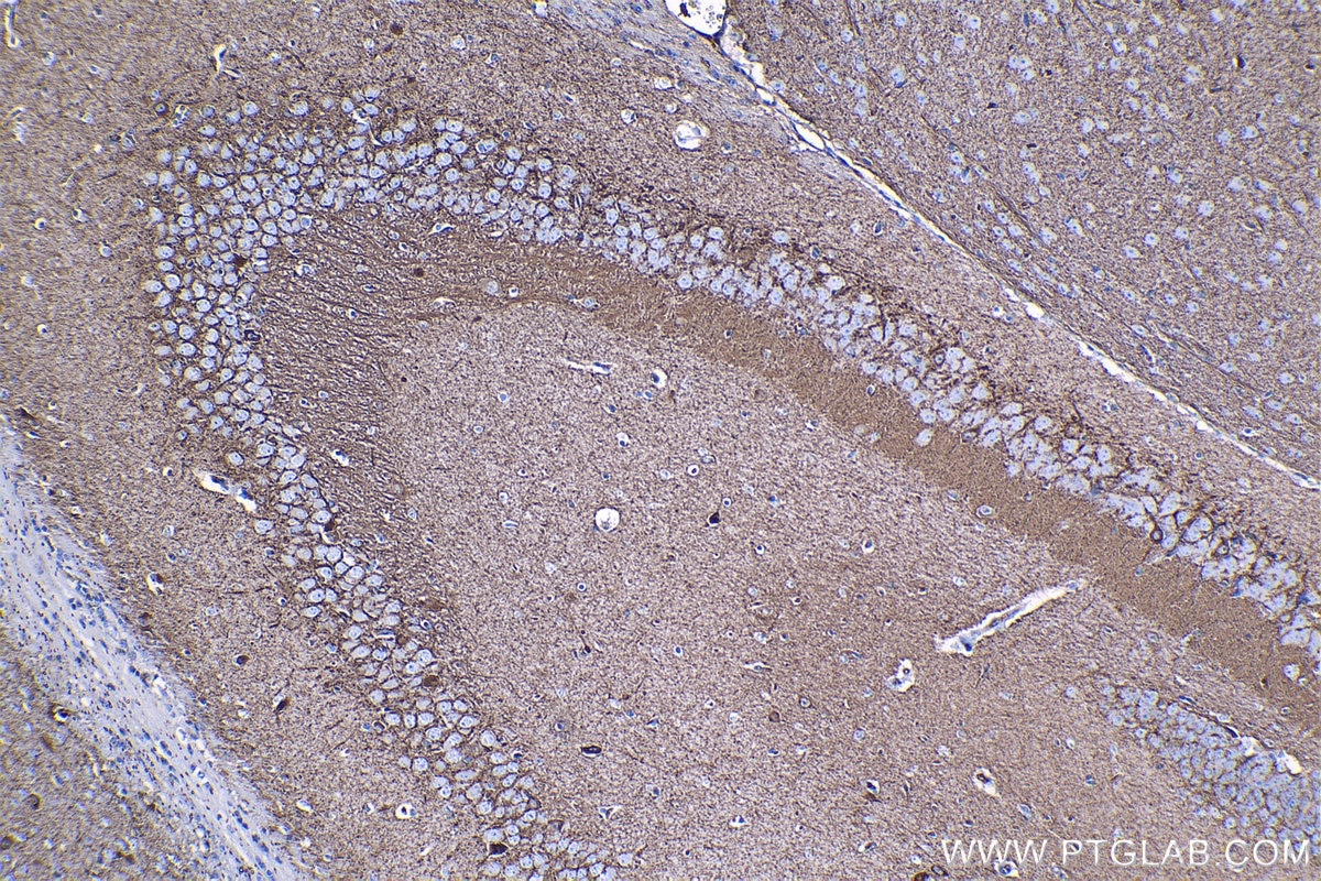 Immunohistochemical analysis of paraffin-embedded mouse brain tissue slide using KHC1339 (GAD1 IHC Kit).