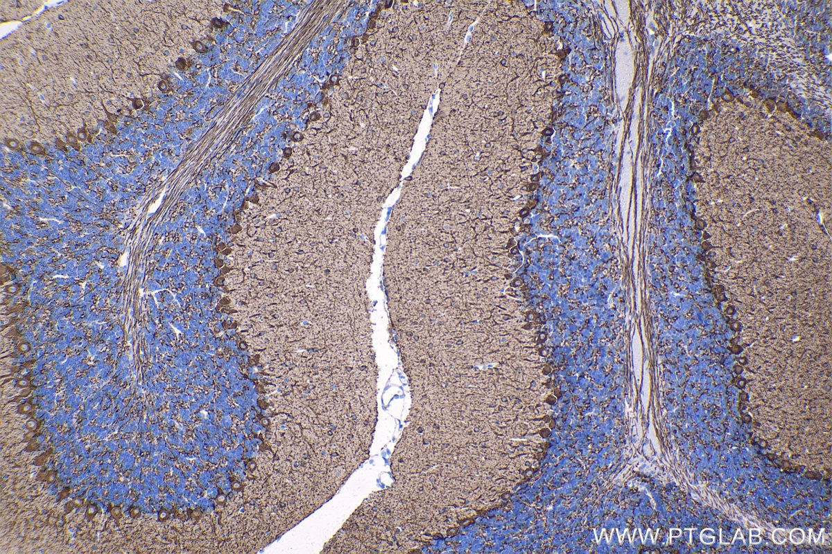 Immunohistochemical analysis of paraffin-embedded mouse cerebellum tissue slide using KHC1339 (GAD1 IHC Kit).
