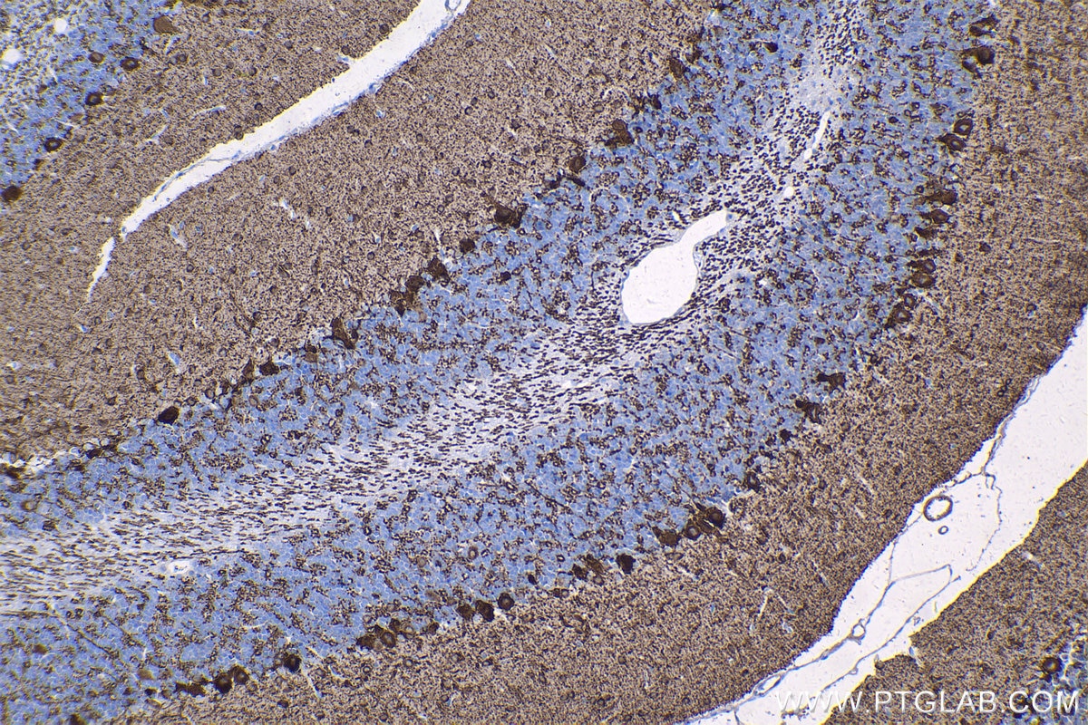 Immunohistochemical analysis of paraffin-embedded rat cerebellum tissue slide using KHC1339 (GAD1 IHC Kit).