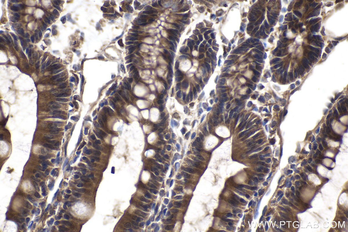 Immunohistochemical analysis of paraffin-embedded rat small intestine tissue slide using KHC2065 (GAK IHC Kit).