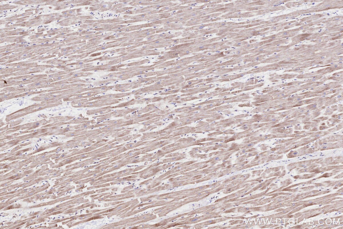 Immunohistochemical analysis of paraffin-embedded human heart tissue slide using KHC3270 (GALNT17/WBSCR17 IHC Kit).