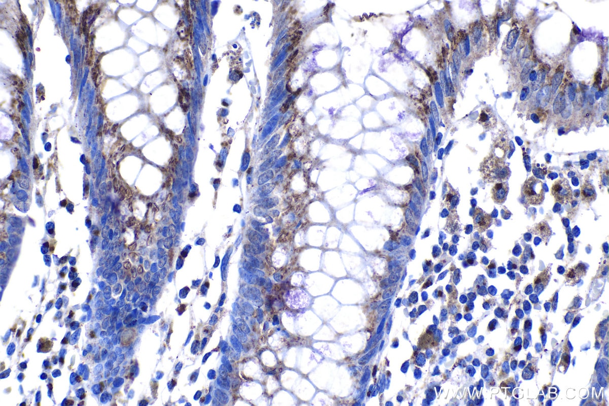 Immunohistochemical analysis of paraffin-embedded human colon tissue slide using KHC1226 (GALNT2 IHC Kit).
