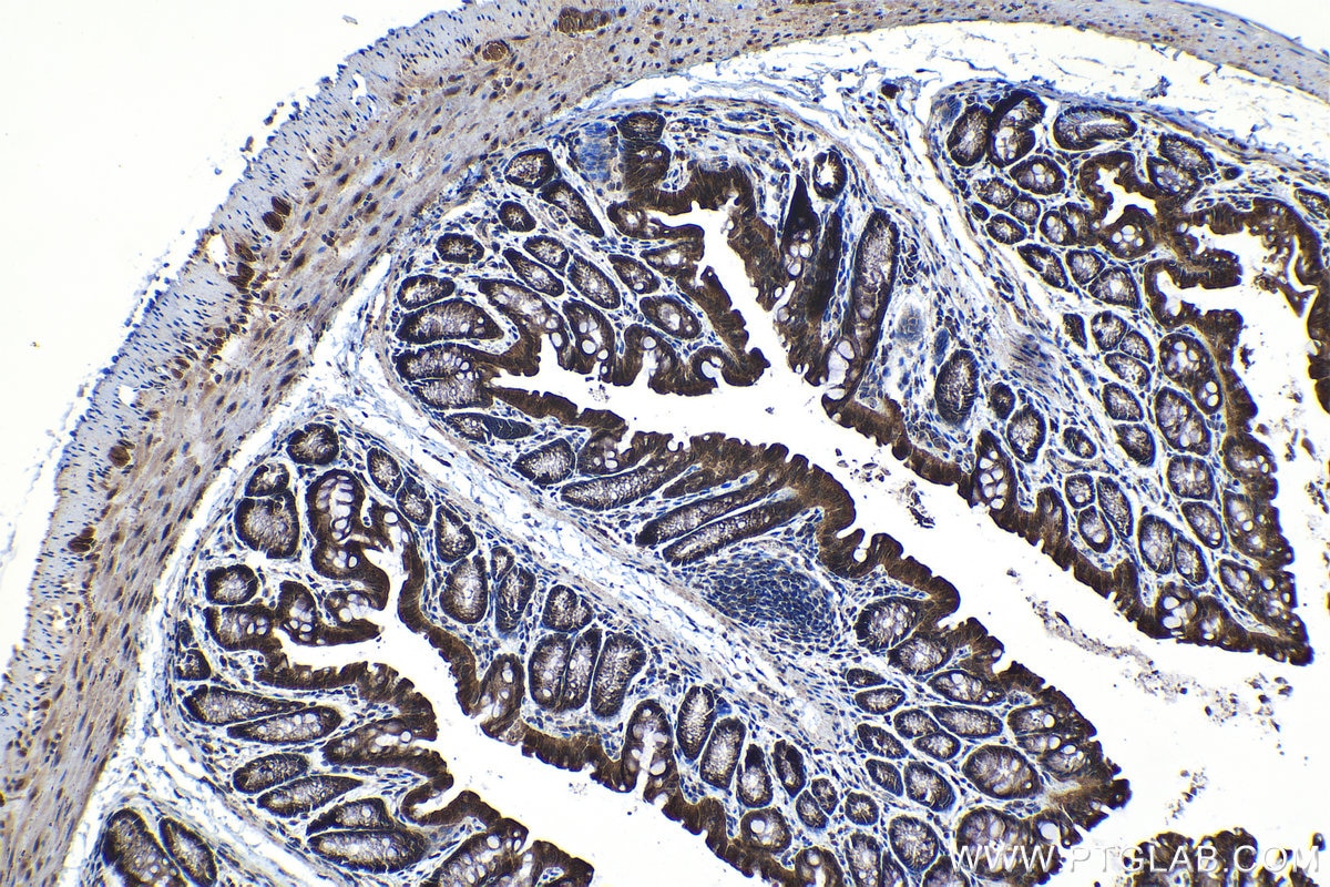 Immunohistochemical analysis of paraffin-embedded mouse colon tissue slide using KHC1226 (GALNT2 IHC Kit).