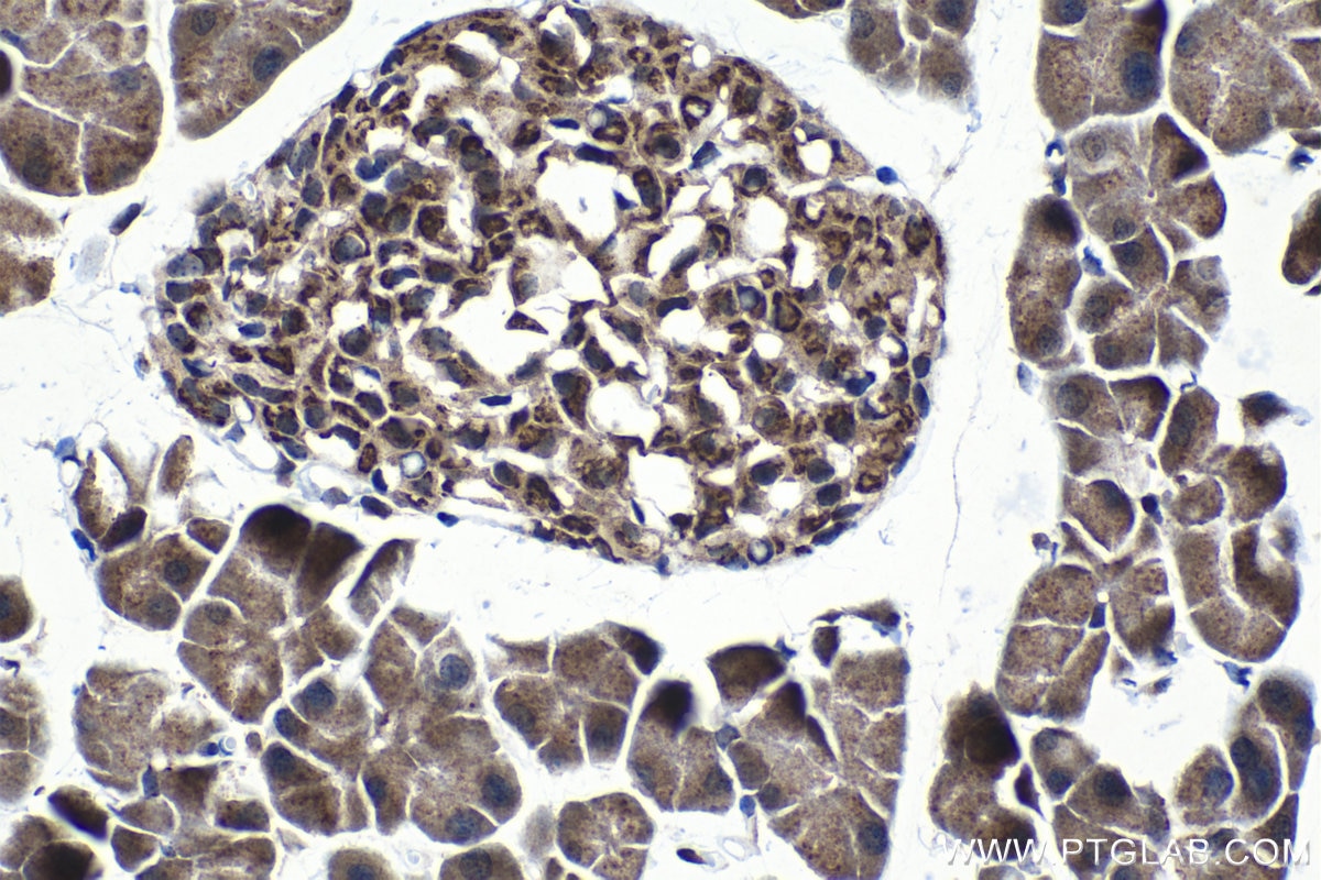 Immunohistochemical analysis of paraffin-embedded mouse pancreas tissue slide using KHC1226 (GALNT2 IHC Kit).