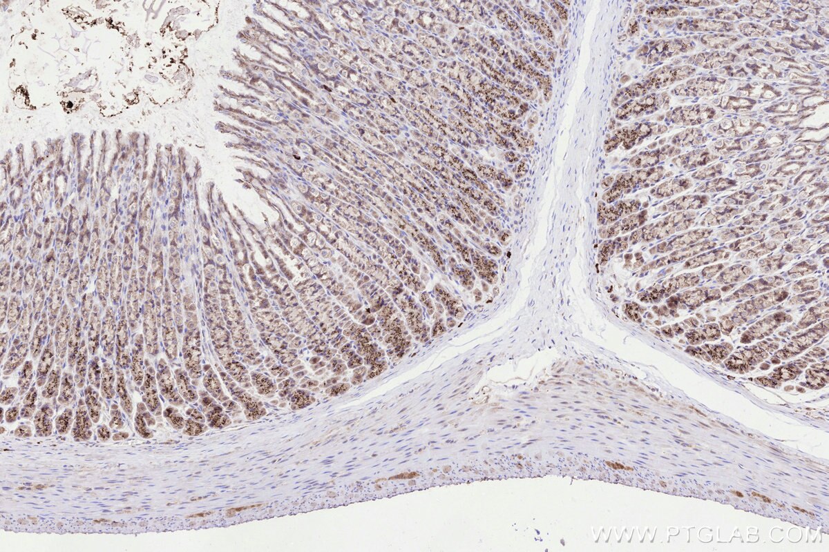 Immunohistochemical analysis of paraffin-embedded rat stomach tissue slide using KHC3288 (GALNT4 IHC Kit). Immunohistochemical analysis of paraffin-embedded rat stomach tissue slide using KHC3288 (GALNT4 IHC Kit).