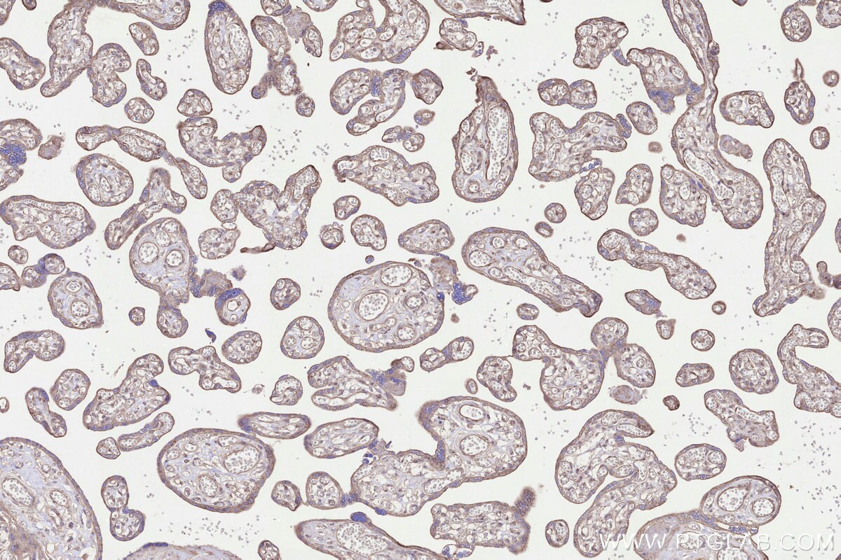 Immunohistochemical analysis of paraffin-embedded human placenta tissue slide using KHC3287 (GALNTL2 IHC Kit).