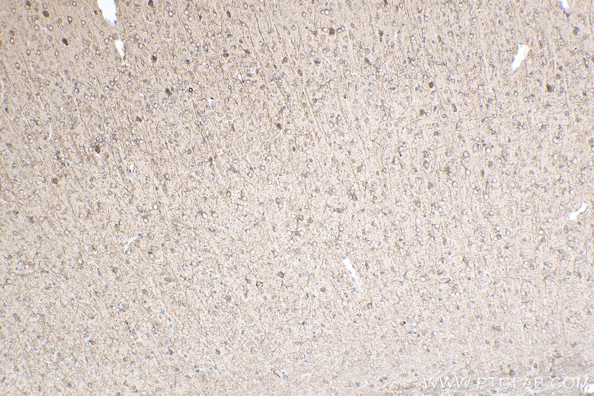 Immunohistochemical analysis of paraffin-embedded mouse brain tissue slide using KHC0810 (GALR2 IHC Kit).