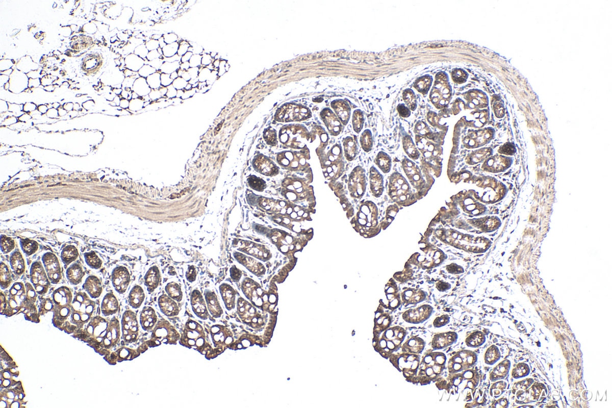 Immunohistochemical analysis of paraffin-embedded mouse colon tissue slide using KHC0810 (GALR2 IHC Kit).