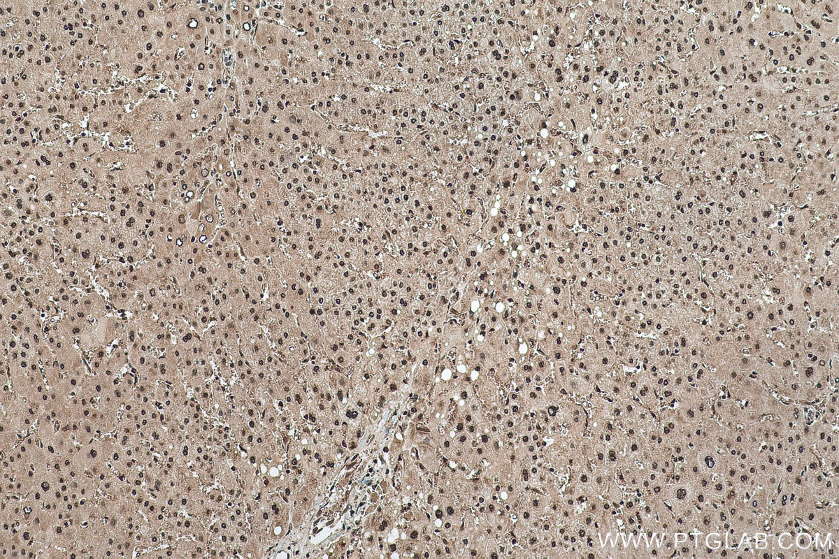 Immunohistochemical analysis of paraffin-embedded human liver tissue slide using KHC0501 (GAPDH IHC Kit).