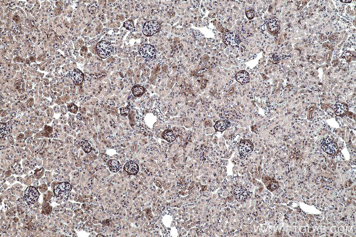 Immunohistochemical analysis of paraffin-embedded mouse kidney tissue slide using KHC0501 (GAPDH IHC Kit).