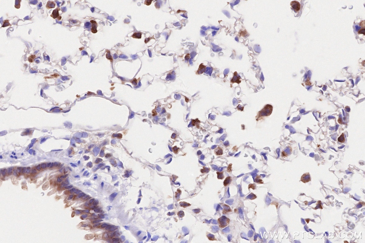 Immunohistochemical analysis of paraffin-embedded rat lung tissue slide using KHC2576 (GARNL1 IHC Kit).