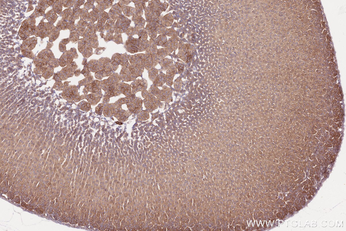 Immunohistochemical analysis of paraffin-embedded mouse adrenal gland tissue slide using KHC2576 (GARNL1 IHC Kit).